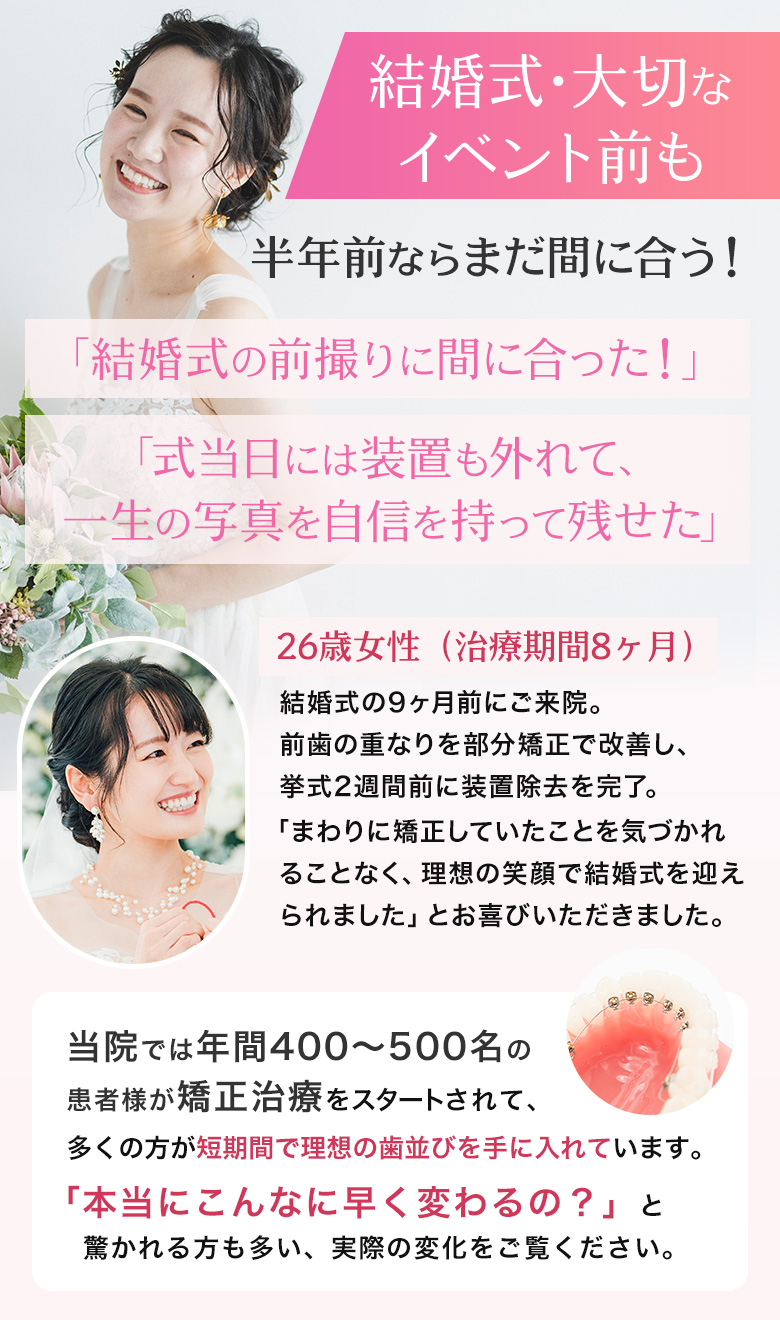 結婚式・大切なイベント前も 半年間ならまだ間に合う！結婚式の前撮りに間に合った！式当日には装置も外れて、一生の写真を自信を持って残せた 26歳女性 治療期間8ヶ月